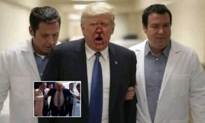President Of US Donald Trump Has Been Struck In The Face And Rushed To The Hospital After…
