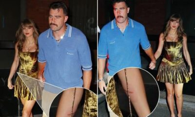 Fans Spot Taylor Swift’s Visible Scars in Photo with Travis Kelce – Fuels New Speculation.