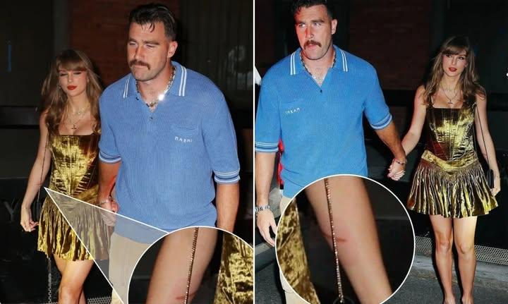 Fans Spot Taylor Swift’s Visible Scars in Photo with Travis Kelce – Fuels New Speculation.