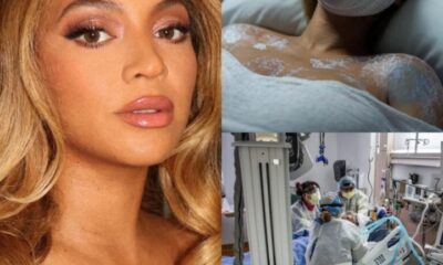 1 Hour Ago, Beyoncé Broke Down On Stage During The Renaissance Tour, Officially Admitting She Couldn’t Hide Her Illness Any Longer, At The Age Of 42, She Had…See More…