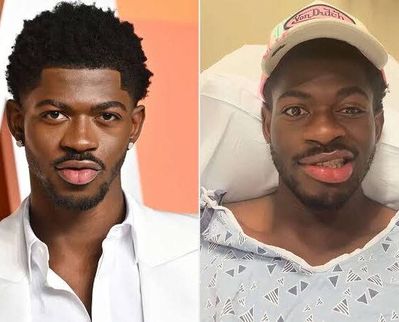 Shock in L.A.: Lil Nas X Arrested And Being Hospitalised After Naked Rampage and Clash with Cops”