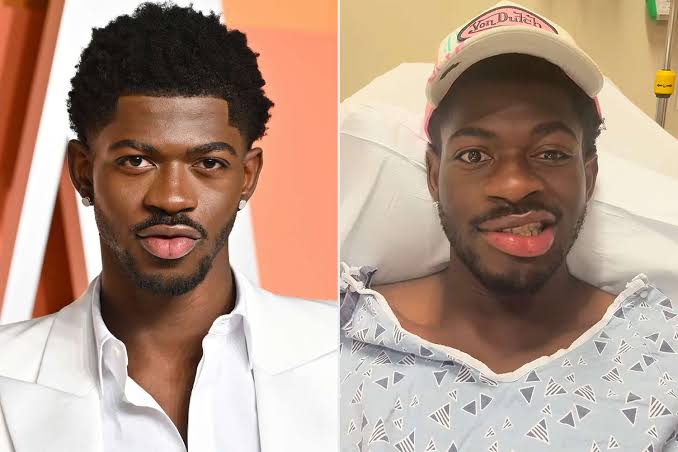 Shock in L.A.: Lil Nas X Arrested And Being Hospitalised After Naked Rampage and Clash with Cops”